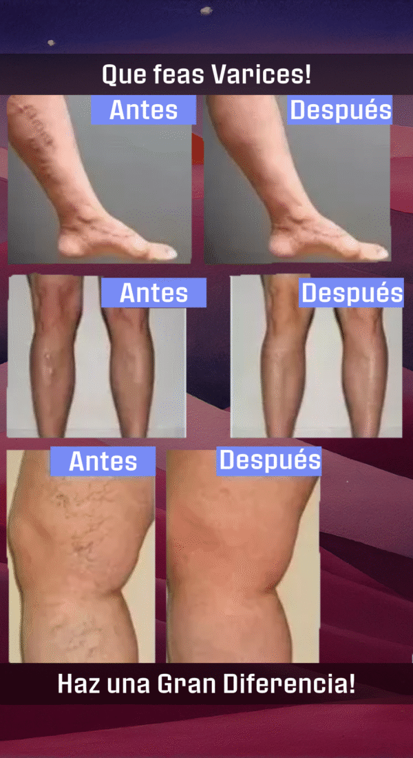 Parches Anti-Varices