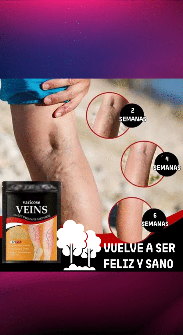 Parches Anti-Varices